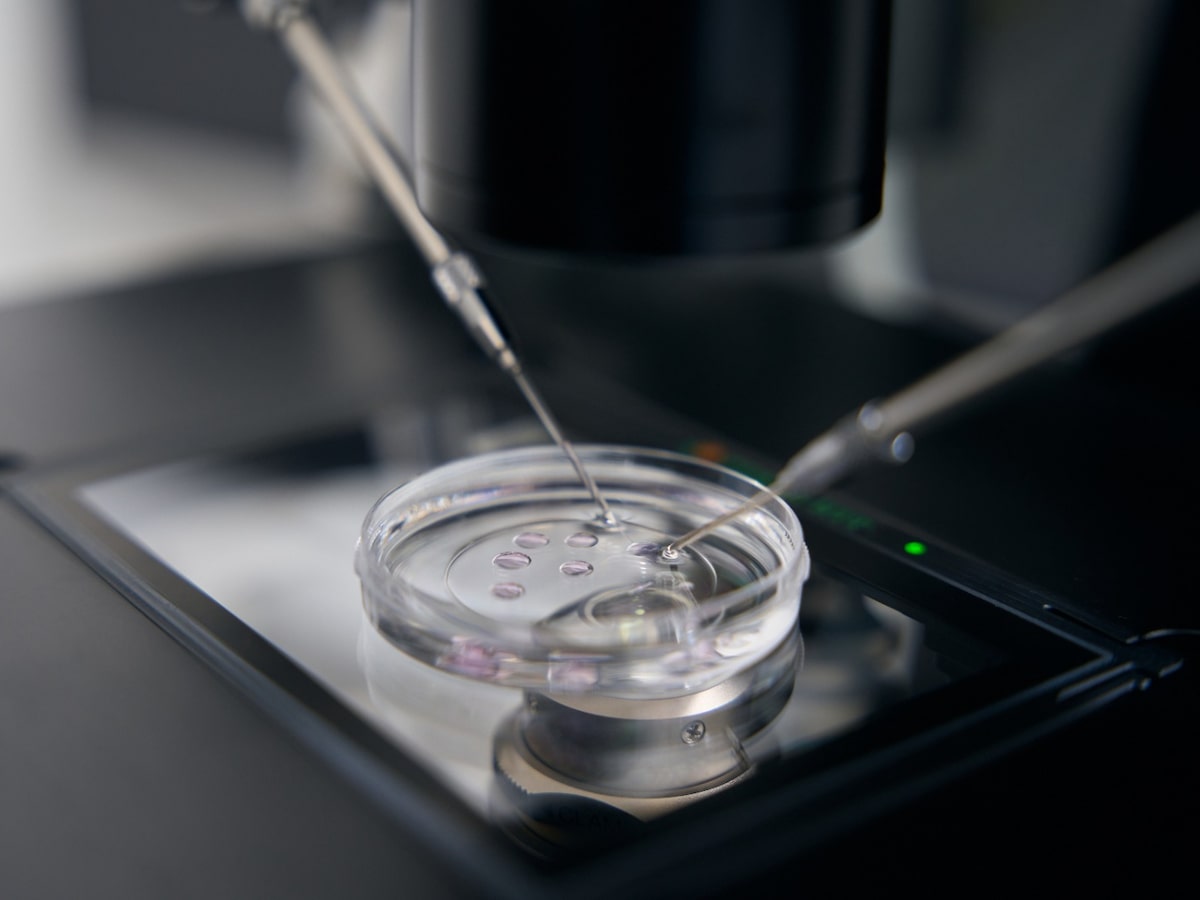 Fertilização in vitro: teste genético de embriões não aumenta taxa de gravidez entre mulheres jovens