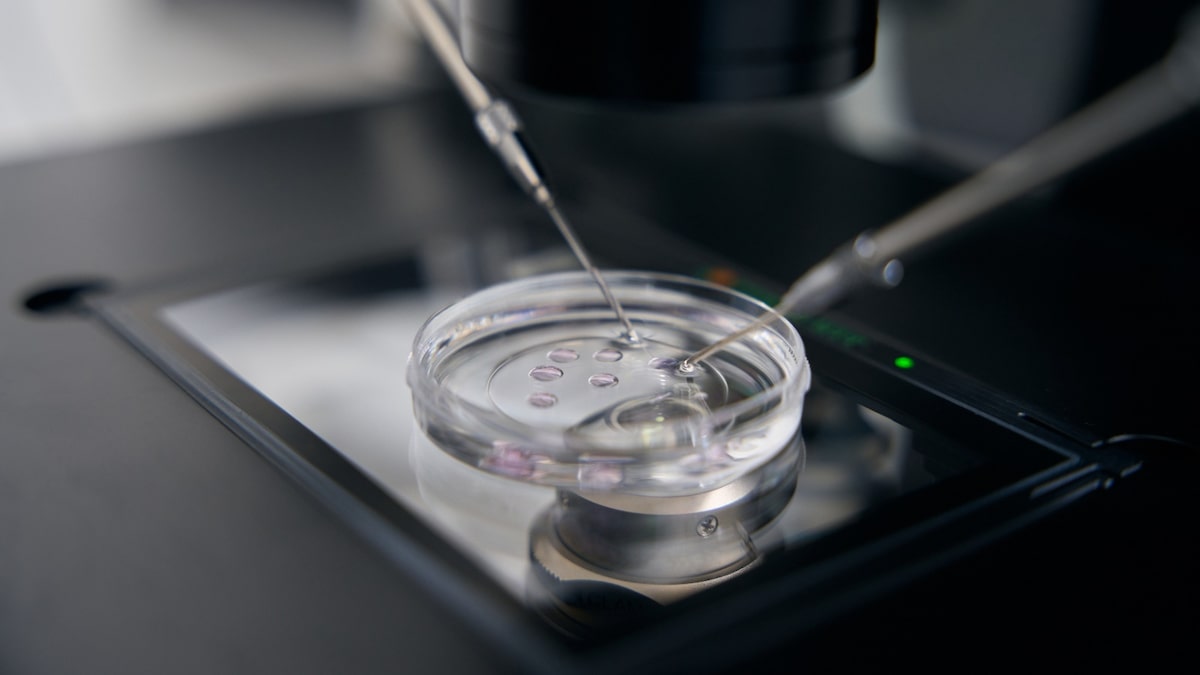 Fertilização in vitro: teste genético de embriões não aumenta taxa de gravidez entre mulheres jovens