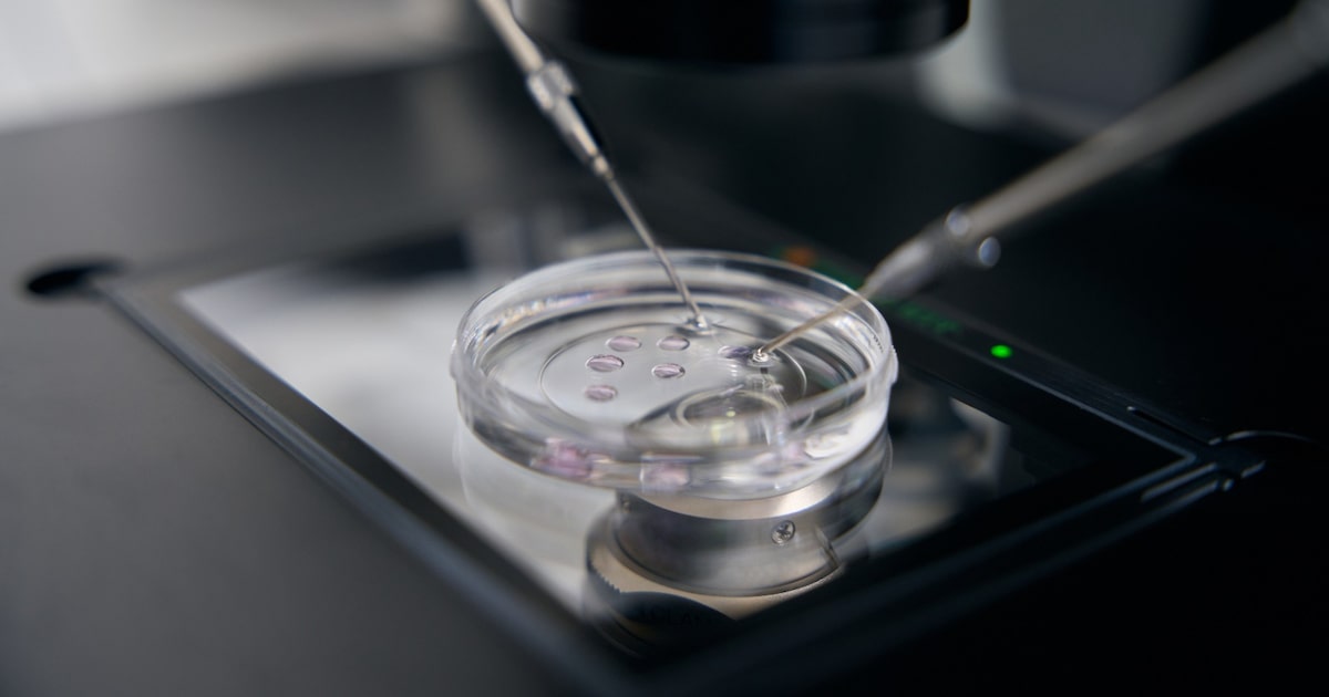 Fertilização in vitro: teste genético de embriões não aumenta taxa de gravidez entre mulheres jovens